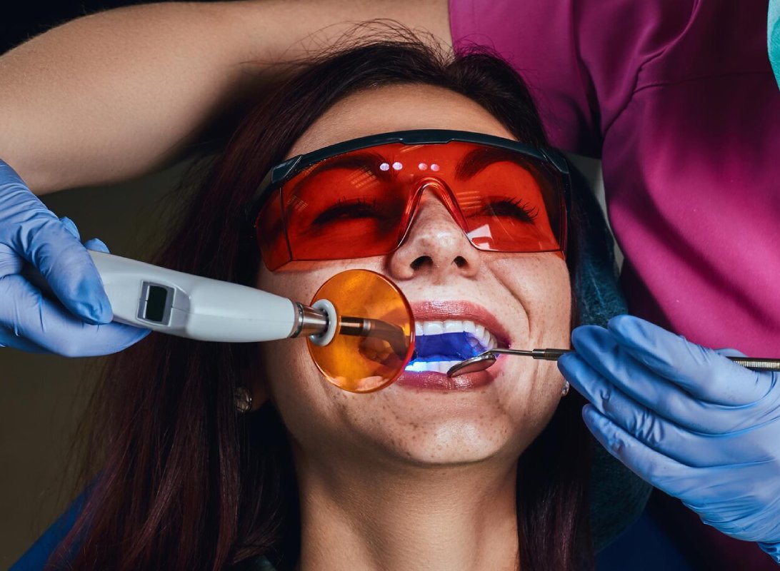 Gum-laser-Shaping-banner