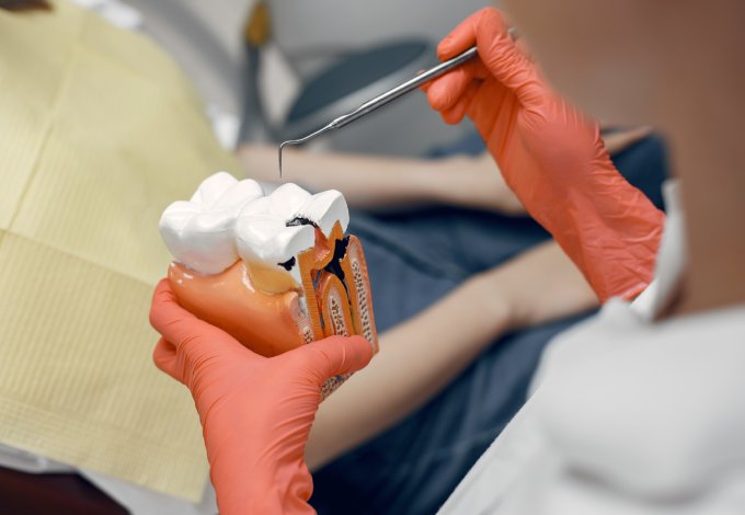 Reasons-for-tooth-extraction