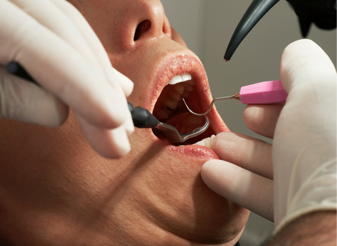 Treatments-banner