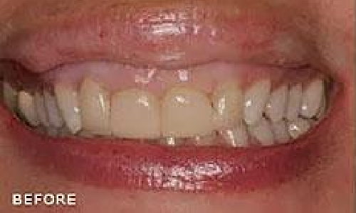 Before