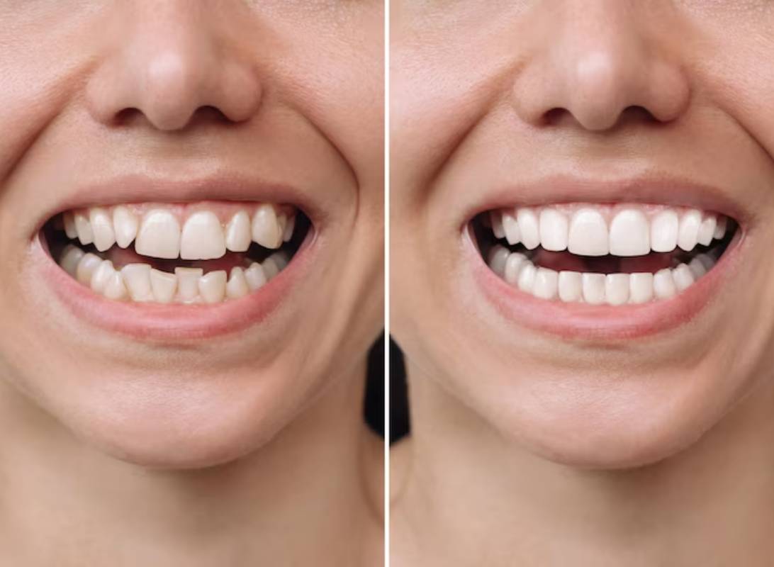before after banner
