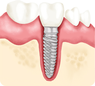 Teeth Img